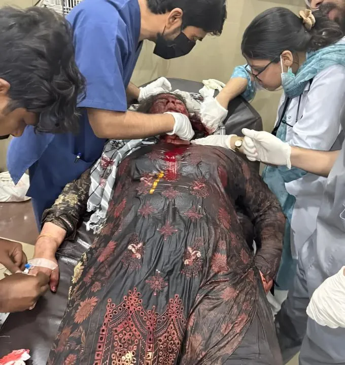 A pakistani women is injured during rocket attack from india on sindoor operation